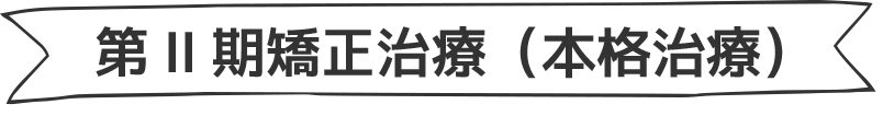 第II期矯正治療（本格治療）